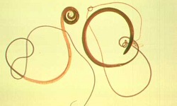Trichuris trichiura